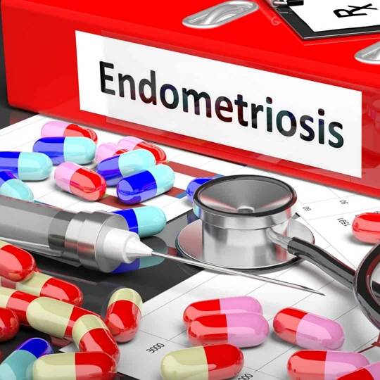 Frauenklasse Endometriose